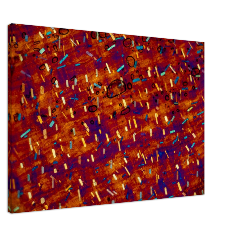 hommage à Paul Klee (Calciumoxalat in der Zwiebel)