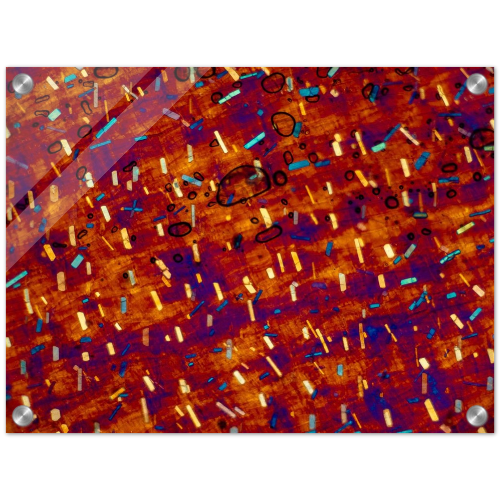 hommage à Paul Klee (Calciumoxalat in der Zwiebel)
