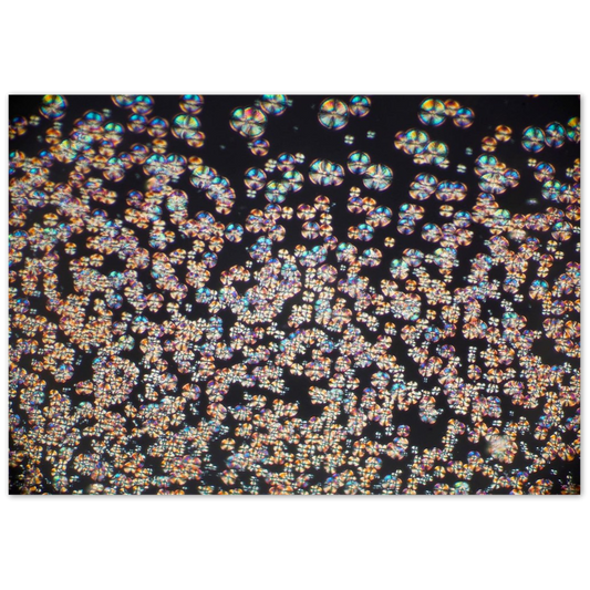 wisdom of crowds (Asparaginsäure)