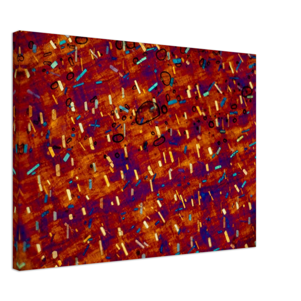 hommage à Paul Klee (Calciumoxalat in der Zwiebel)