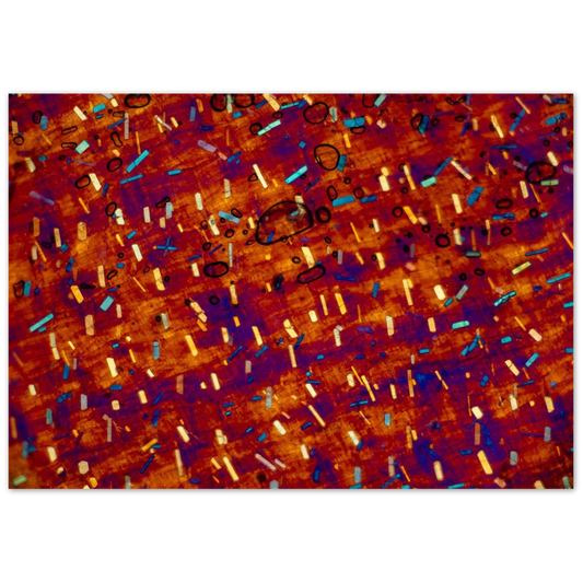 hommage à Paul Klee (Calciumoxalat in der Zwiebel)