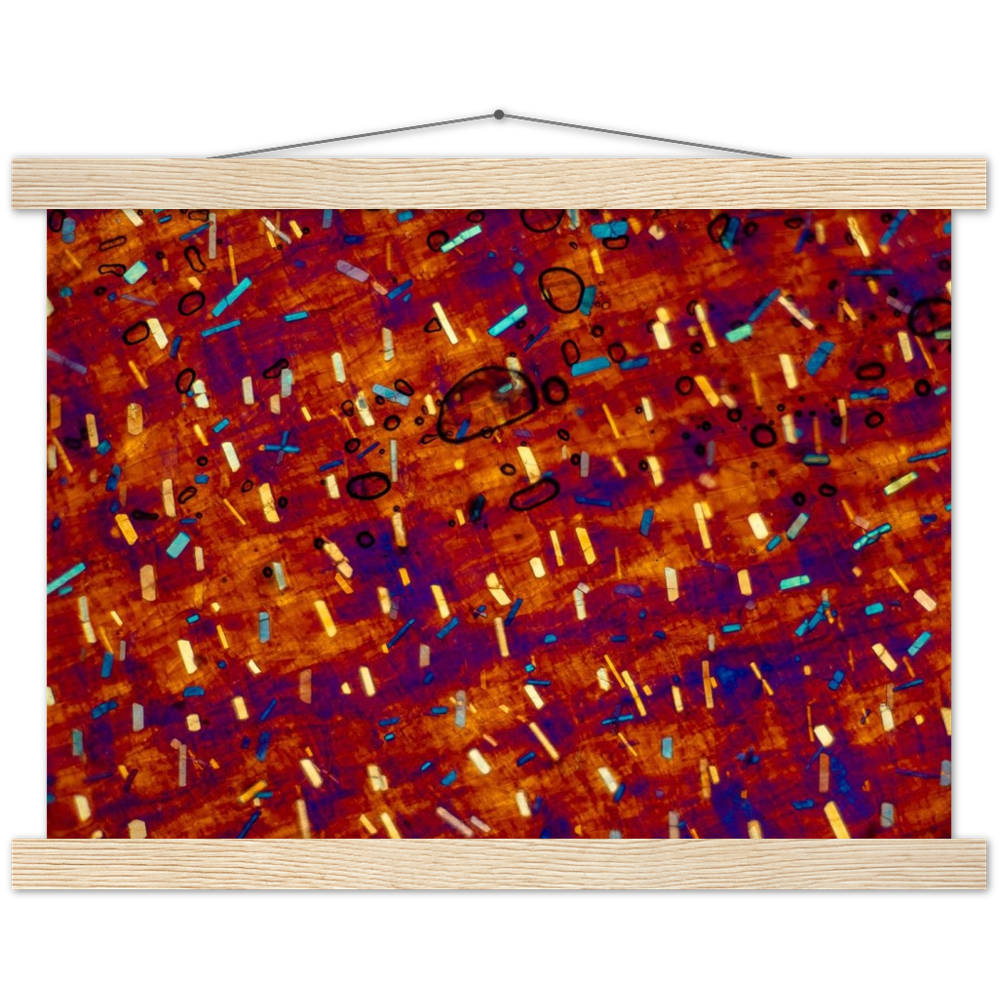 hommage à Paul Klee (Calciumoxalat in der Zwiebel)